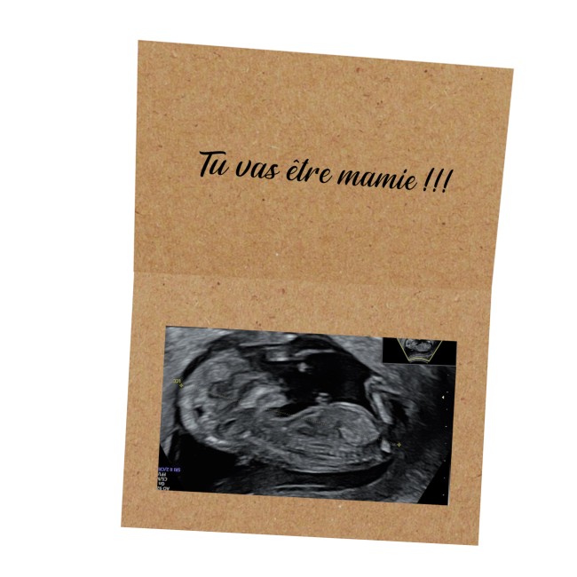 Carte Annonce grossesse personnalisée - Pochette pour échographie avec texte personnalisé - EPB
