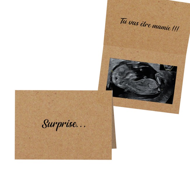 Carte Annonce grossesse personnalisée - Pochette pour échographie avec texte personnalisé - EPF Carte Annonce grossesse personnalisée - Pochette pour échographie avec texte personnalisé - EPF